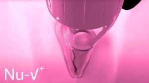 Vaginal rejuvenation 10 silvery blue womens health clinic vaginal rejuvenation laser 1