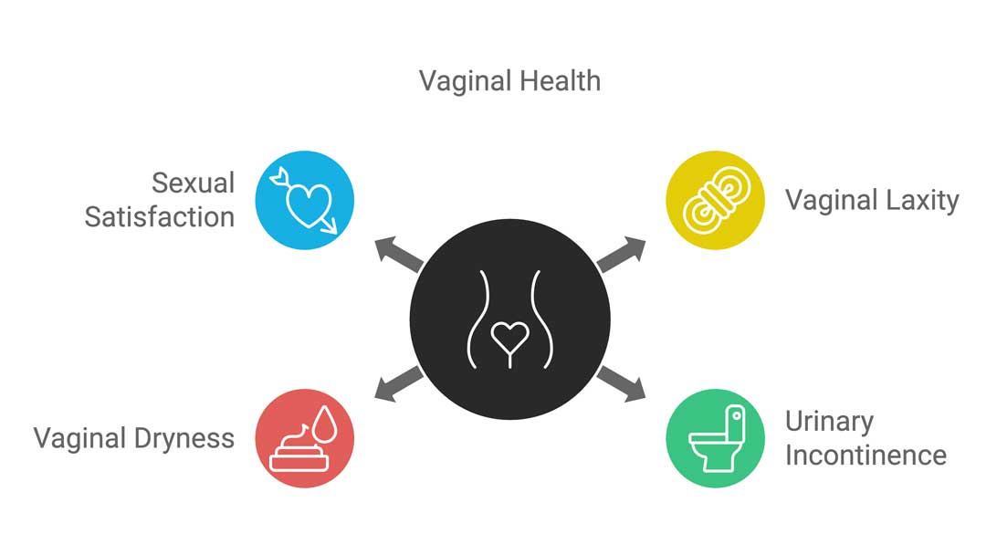 Diagram from the Women's Health Clinic showing conditions treated by laser vaginal rejuvenation. At the center, there is a circular icon of a woman's lower body with a heart shape on the pelvic area, representing vaginal health. Four arrows extend outward to different icons representing related conditions. These include 'Sexual Satisfaction' with a blue heart and arrows, 'Vaginal Laxity' with a yellow stretching icon, 'Urinary Incontinence' with a green toilet icon, and 'Vaginal Dryness' with a red droplet and moisture icon.