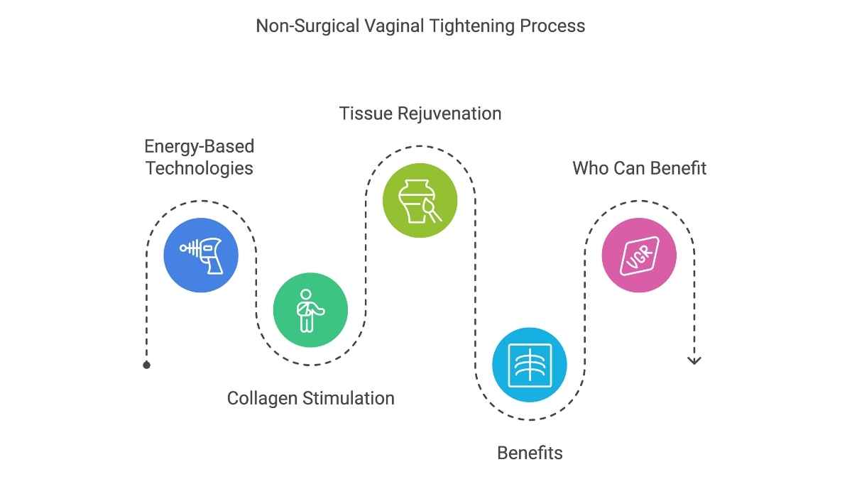 Infographic titled 'Non-Surgical Vaginal Tightening Process' depicting a flow of steps with dotted lines connecting icons. The steps are: Energy-Based Technologies, represented by a blue icon with a laser device; Collagen Stimulation, shown as a green icon with a figure emphasizing the pelvic area; Tissue Rejuvenation, displayed with a green icon featuring a rejuvenating cream jar; Benefits, illustrated with a blue icon of a healthy tissue symbol; and Who Can Benefit, represented by a pink icon labeled 'VCR.' The design uses a playful and organized layout to visually explain the process