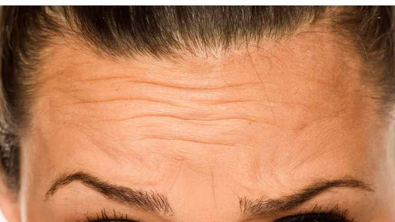 Doctor-led expression lines consultation at The Women’s Health Clinic