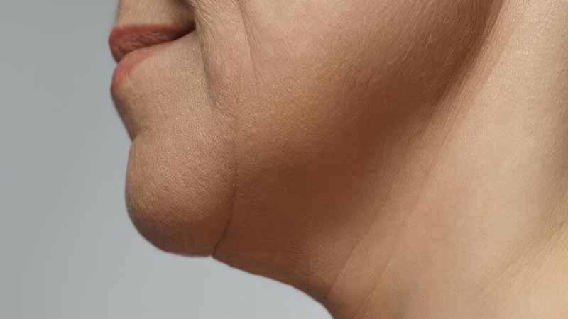 Doctor-led jawline chin and lower-face contour consultation at The Women’s Health Clinic