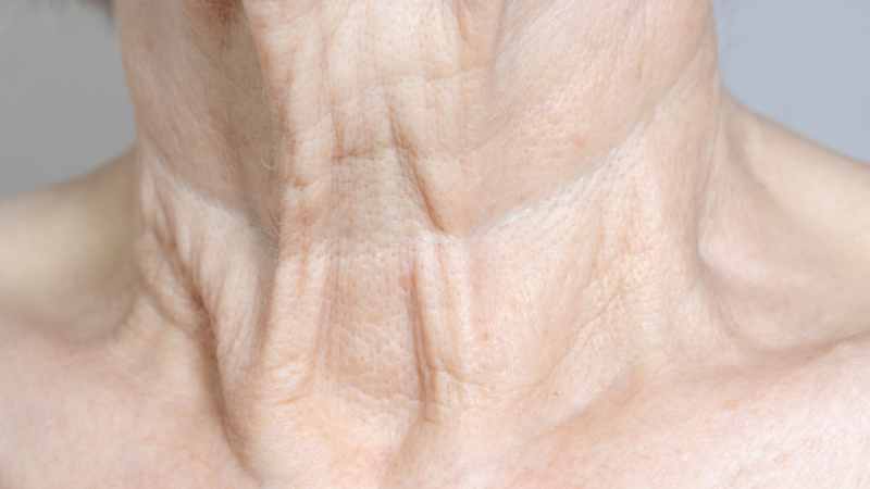 Doctor-led neck lines and neck ageing consultation at The Women’s Health Clinic