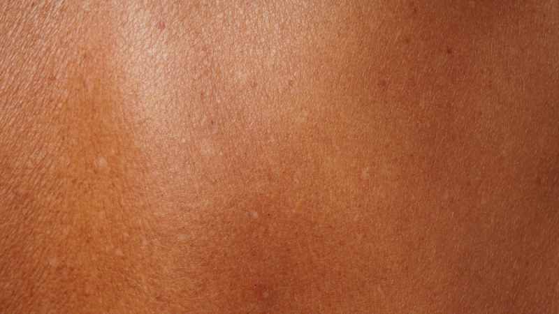 Doctor-led sun damage, age spots and dull skin consultation at The Women’s Health Clinic