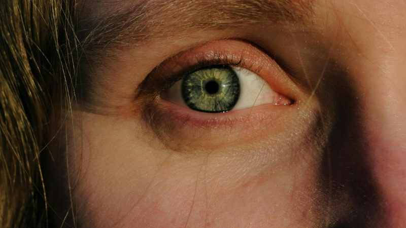 Doctor-led under-eye concerns consultation at The Women’s Health Clinic